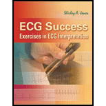 ECG Success  Exercises in ECG Interpretation