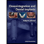 Osseointegration and Dental Implants