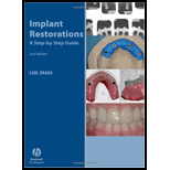 Implant Restorations Step by Step Guide