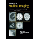 Handbook of Medical Imaging, Volume 2