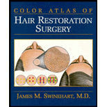 Color Atlas of Hair Restoration Surgery