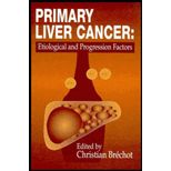 Primary Liver Cancer  Etiological and Progression Factors