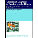 Ultrasound Diagnosis of Cerebrovascular Disease  Doppler Sonography of the Extra and Intracranial Arteries Duplex Scanning