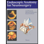 Endoscopic Anatomy for Neurosurgery