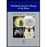 Minimally Invasive Therapy of the Brain