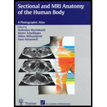 Sectional and MRI Anatomy of Human Body