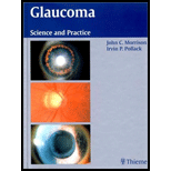 Glaucoma Science and Practice