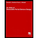 Atlas of Removable Partial Denture Design