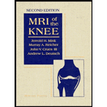 MRI of the Knee