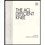 ACL Deficient Knee