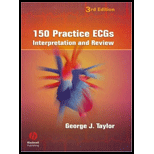 150 Practice ECGs