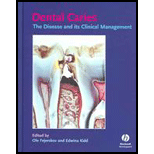 Dental Caries