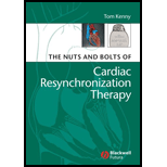 Nuts and Bolts of Cardiac Resynchronization Therapy