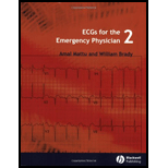 ECGS FOR THE EMERGENCY PHYSICIAN 2