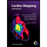 Cardiac Mapping