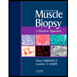 Muscle Biopsy  A practical approach