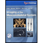 Imaging of Musculoskeletal System, Volume 1 and 2