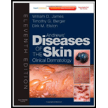 Andrews Diseases of Skin