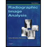 Radiographic Imaging Analysis