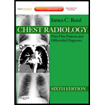 Chest Radiology