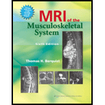 MRI of the Musculoskeletal System