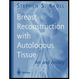 Breast Reconstruction with Autologous Tissue