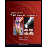 Essentials in Total Knee Arthroplasty