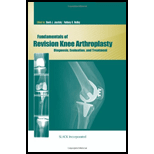 Fund of Revision Knee Arthroplasty