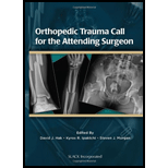 Orthopedic Trauma Call for the Attending Surgeon