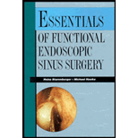 Essentials of Functional Sinus Surgery