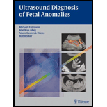 Ultrasound Diagnosis of Fetal Anomalies