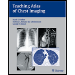 TEACHING ATLAS OF CHEST IMAGING