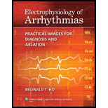 Electrophysiology of Arrhythmias