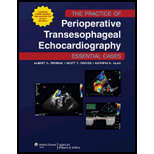 Practice of Perioperative Transesophageal Echocardiography  Essential Cases