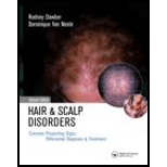 Hair and Scalp Disorders  Common Presenting Signs, Differential Diagnosis and Treatment