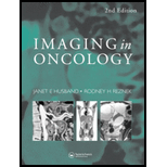 Imaging in Oncology Volume 1 and 2