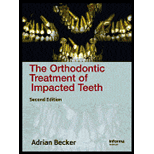 Orthodontic Treatment of Impacted Teeth