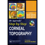 Step by Step Corneal Topography