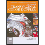 Atlas of Transvaginal Color Doppler