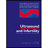 Ultrasound and Infertility