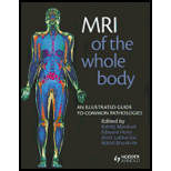 MRI of the Whole Body