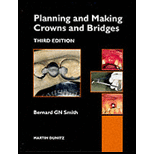 Planning and Making Crowns and Bridges