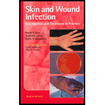 Skin and Wound Infection