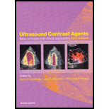 Ultrasound Contrast Agents