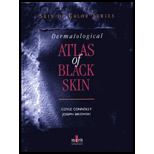 Dermatological Atlas of Black Skin