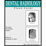 Dental Radiology Flash Cards