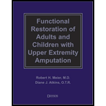 Functional Restoration of Adults and Children With Upper Extremity Amputation