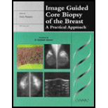 Image Guided Core Biopsy of the Breast