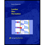 Lumbar Disc Herniation