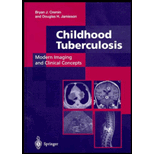 Childhood Tuberculosis  Modern Imaging & Clinical Concepts